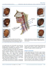 "Development of an Experimental Model for Studying the Nasosinusal and Skull Base Arterial and Venous Systems Using Iodinated Contrast and Latex in Cadavers"