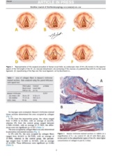 "Effect of application of fibrin glue on vocal fold healing after surgical manipulation in rabbits"