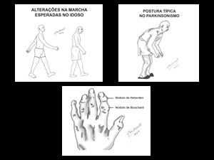 Ilustrações para capítulo de geriatria