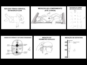 Ilustrações para capítulo de pediatria