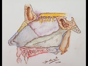 Parede Medial do Nariz